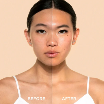 Unlock Your Skin's True Radiance Today!